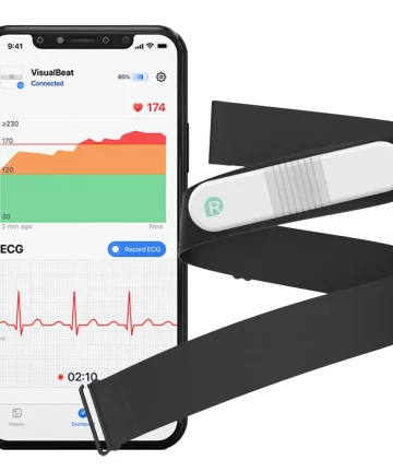 AI Holter ECG/EKG Monitoring