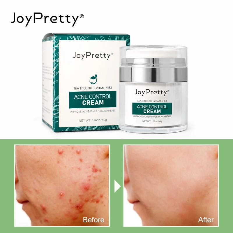 JoyPretty Tea Tree Treatment Face Cream