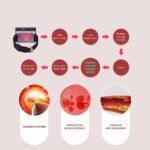 Laser Therapy Watch