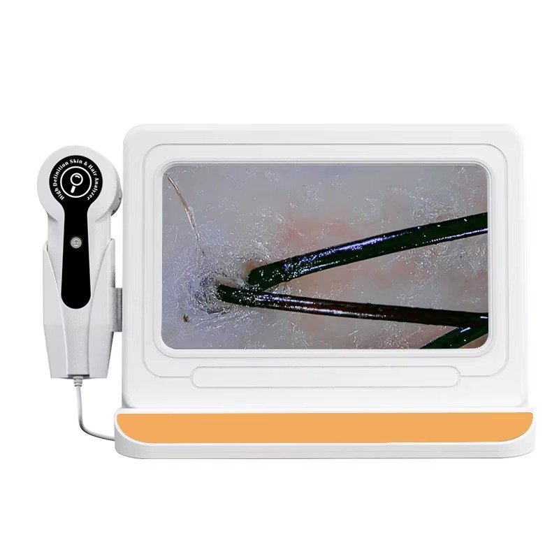 Skin Hair Scalp Detector
