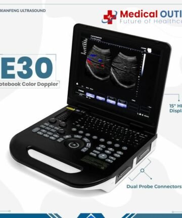 Notebook Ultrasound Machine
