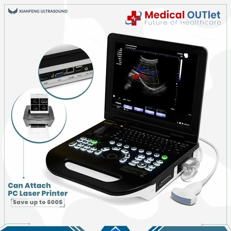 Notebook Ultrasound Machine Notebook Ultrasound Machine