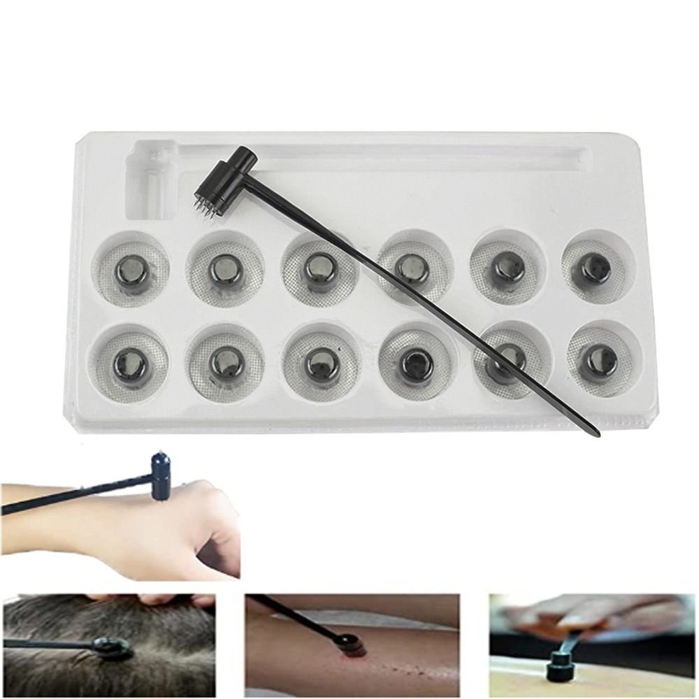 7 Star Needle Dermal Hammer – Plum Blossom Blood Needle | Medical Outlet 7 Star Needle Dermal Hammer plum blossom needle set with 12 replaceable heads in use