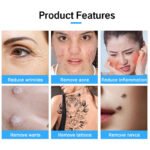 Facial Beauty Plasma Pen product features - wrinkles acne warts tattoo removal Pakistan