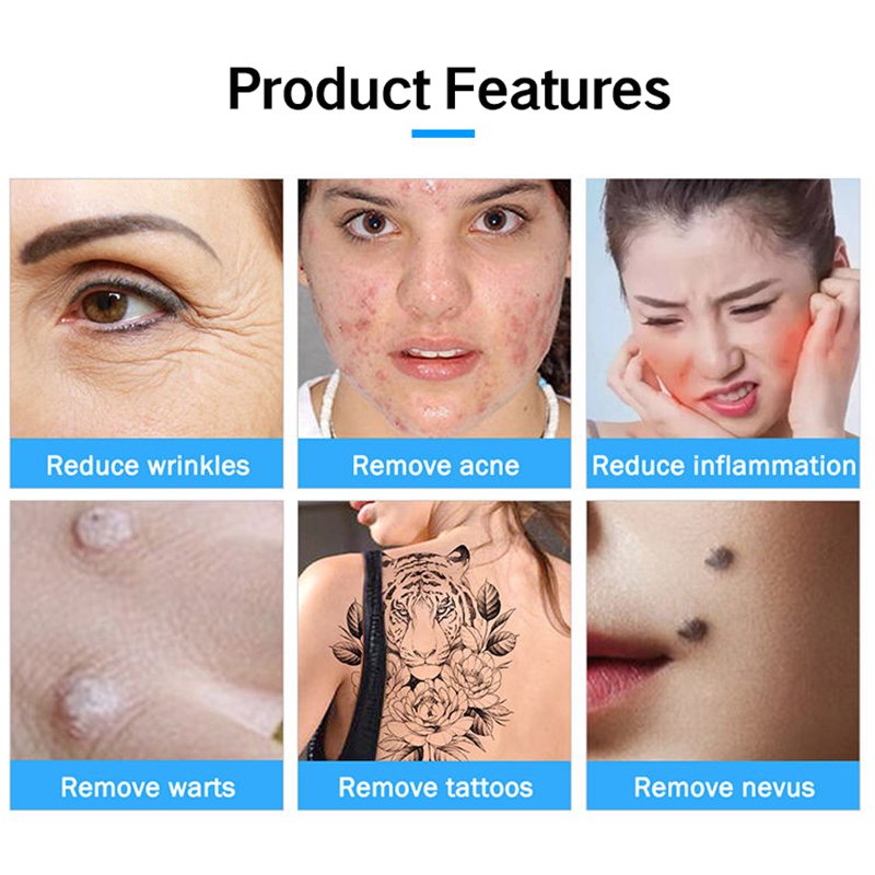 Facial Beauty Plasma Pen product features - wrinkles acne warts tattoo removal Pakistan