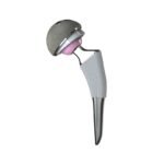 Cementless Femoral Stem Hip Prosthesis