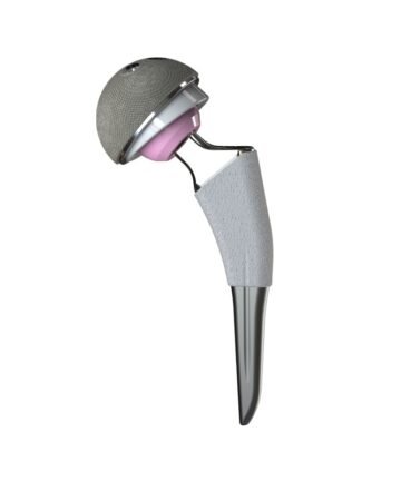 Cementless Femoral Stem Hip Prosthesis