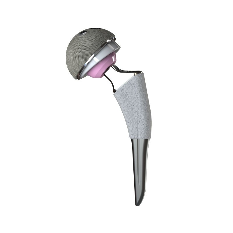 Cementless Femoral Stem Hip Prosthesis
