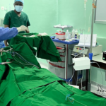 Otolaryngology Plasma Coagulation Device